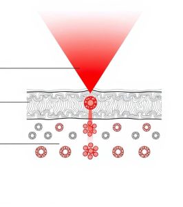 Line drawing showing red light therapy penetrating skin layers to stimulate collagen production for treating loose skin