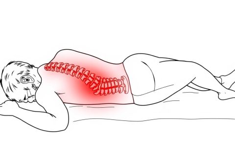 Line drawing of a person with a herniated disc receiving red light therapy treatment